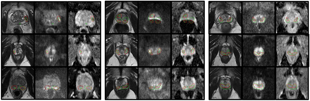 A set of prostate scans.